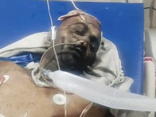 जयपुर के SMS हॉस्पिटल  में आग, 8 मरीजों की मौत