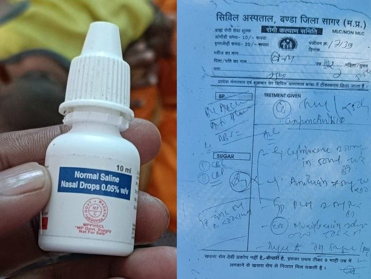 कुपोषण के कारण बच्चे की रोशनी गई, नोजल ड्रॉप से संक्रमण नकार