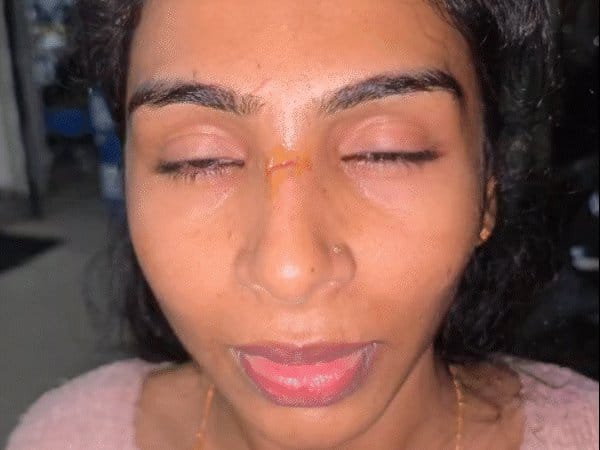 इटारसी ओवरब्रिज पर चाइनीज मांझे से दो घायल, पुलिस करेगी कार्रवाई